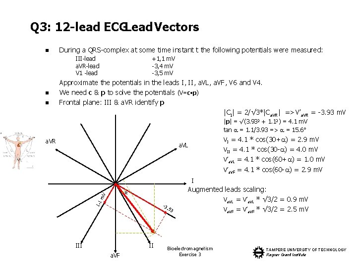 Q 3: 12 -lead ECGLead Vectors n During a QRS-complex at some time instant