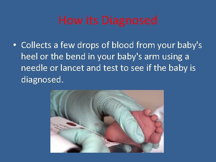 How its Diagnosed • Collects a few drops of blood from your baby's heel