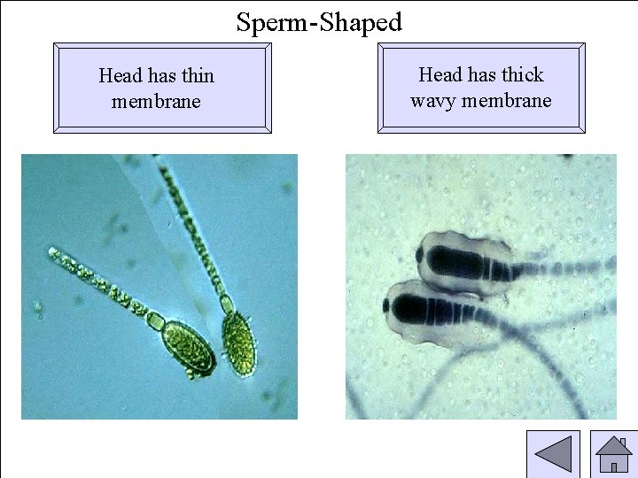 Sperm-Shaped Head has thin membrane Head has thick wavy membrane 