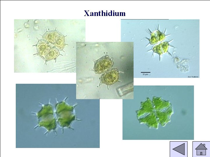 Xanthidium 