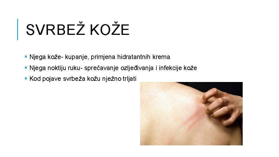 SVRBEŽ KOŽE § Njega kože- kupanje, primjena hidratantnih krema § Njega noktiju ruku- sprečavanje