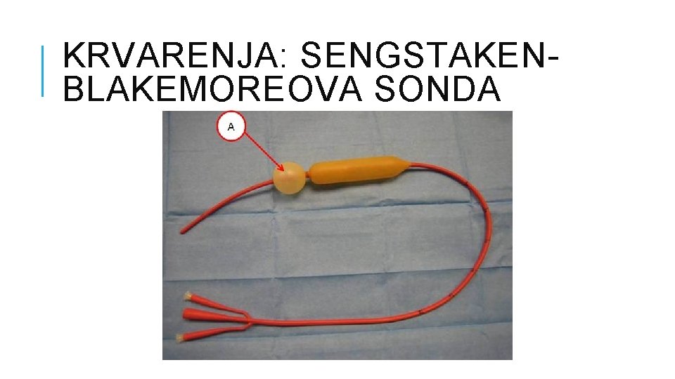 KRVARENJA: SENGSTAKENBLAKEMOREOVA SONDA 