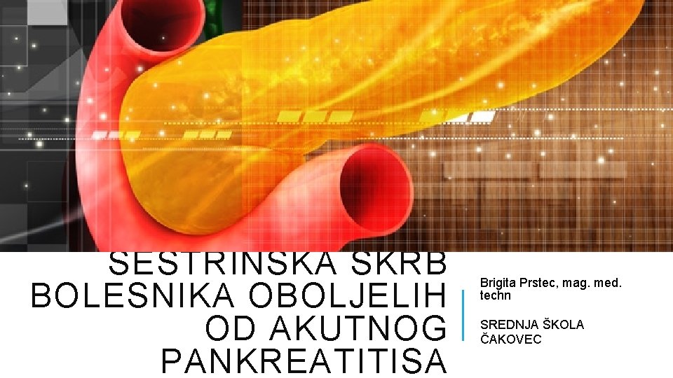 SESTRINSKA SKRB BOLESNIKA OBOLJELIH OD AKUTNOG PANKREATITISA Brigita Prstec, mag. med. techn SREDNJA ŠKOLA