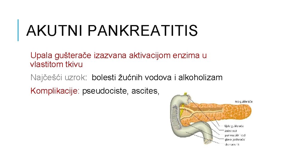 AKUTNI PANKREATITIS Upala gušterače izazvana aktivacijom enzima u vlastitom tkivu Najčešći uzrok: bolesti žućnih