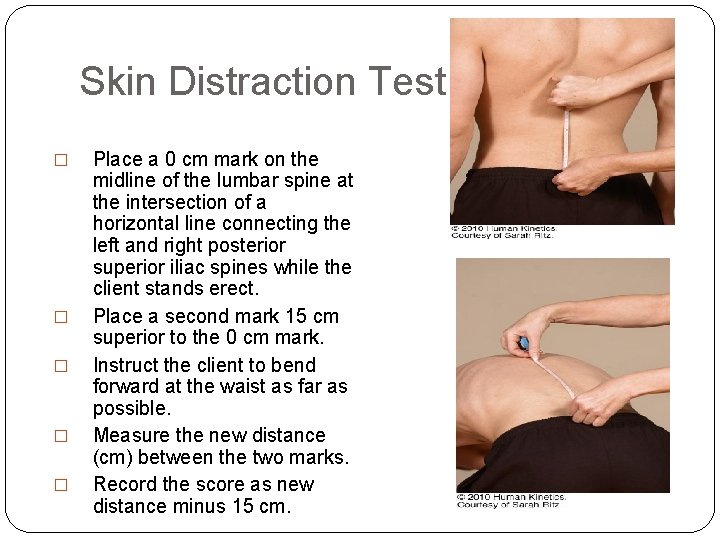 Skin Distraction Test � � � Place a 0 cm mark on the midline