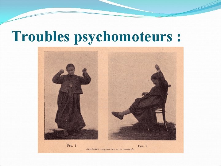 Troubles psychomoteurs : 