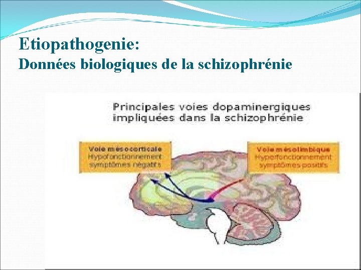Etiopathogenie: Données biologiques de la schizophrénie 