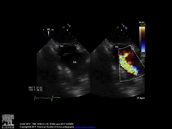 CASE 2017 1150 -154 DOI: (10. 1016/j. case. 2017. 04. 006) Copyright © 2017