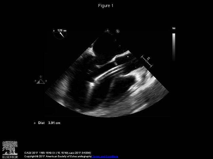 Figure 1 CASE 2017 1150 -154 DOI: (10. 1016/j. case. 2017. 04. 006) Copyright