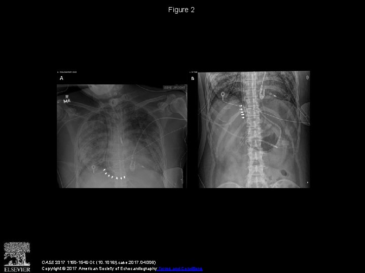 Figure 2 CASE 2017 1150 -154 DOI: (10. 1016/j. case. 2017. 04. 006) Copyright