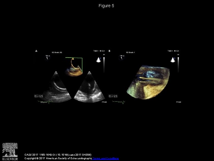 Figure 5 CASE 2017 1150 -154 DOI: (10. 1016/j. case. 2017. 04. 006) Copyright