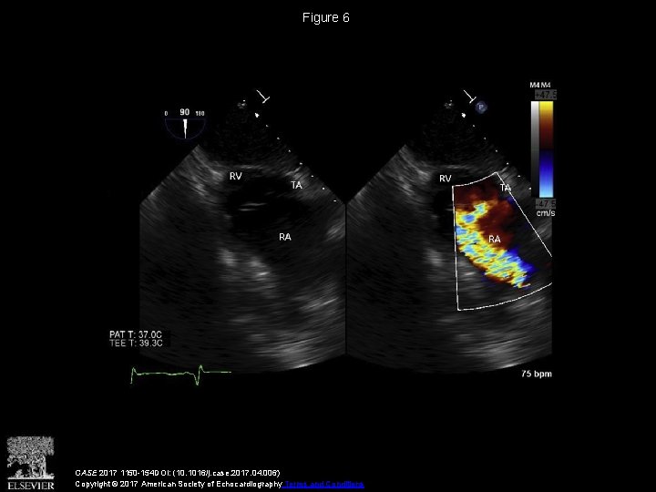 Figure 6 CASE 2017 1150 -154 DOI: (10. 1016/j. case. 2017. 04. 006) Copyright