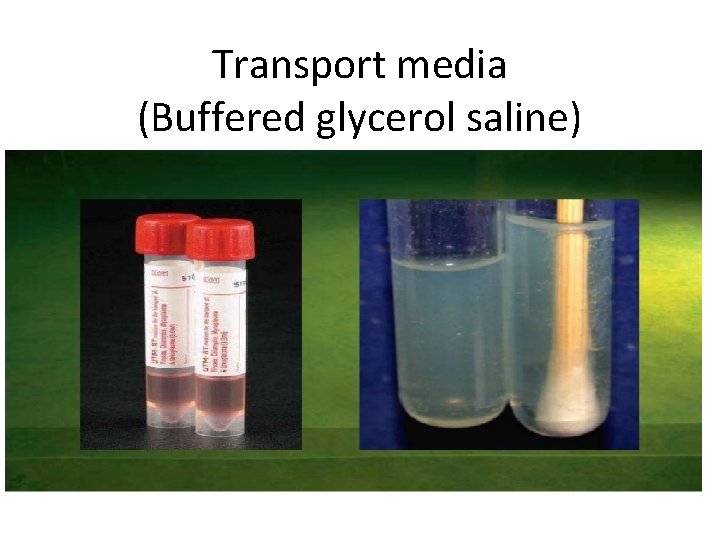 Transport media (Buffered glycerol saline) 