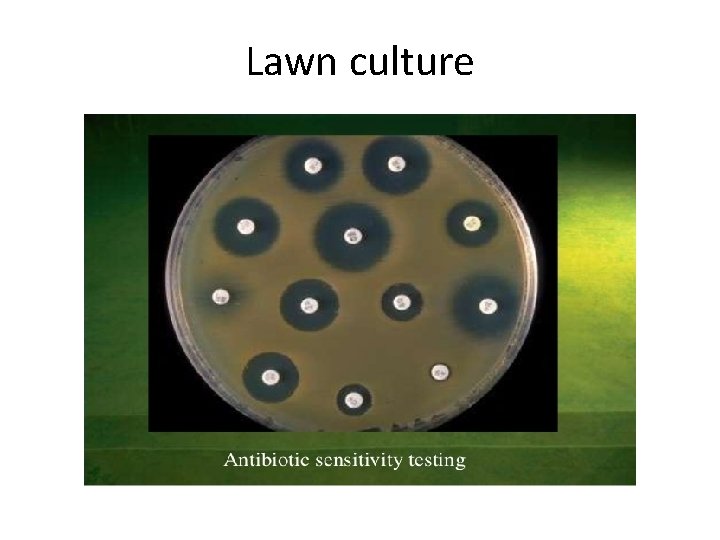 Lawn culture 