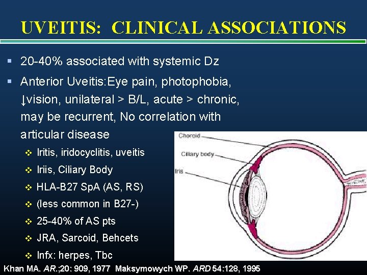 UVEITIS: CLINICAL ASSOCIATIONS § 20 -40% associated with systemic Dz § Anterior Uveitis: Eye