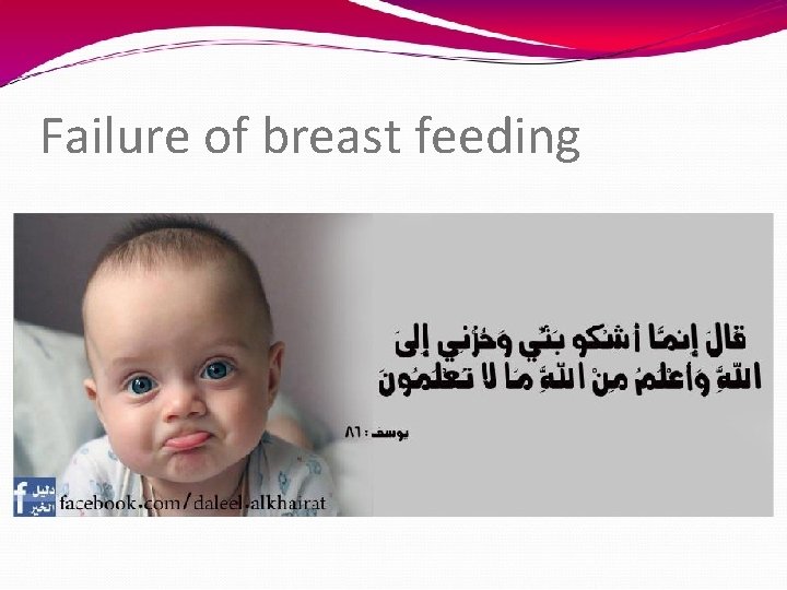 Failure of breast feeding 