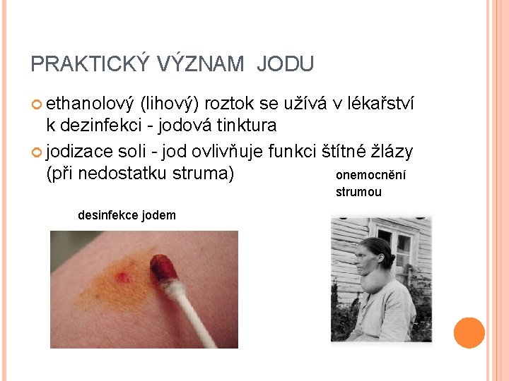 PRAKTICKÝ VÝZNAM JODU ethanolový (lihový) roztok se užívá v lékařství k dezinfekci - jodová