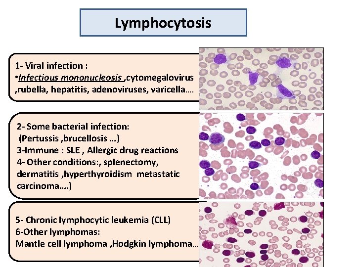 Lymphocytosis 1 - Viral infection : • Infectious mononucleosis , cytomegalovirus , rubella, hepatitis,