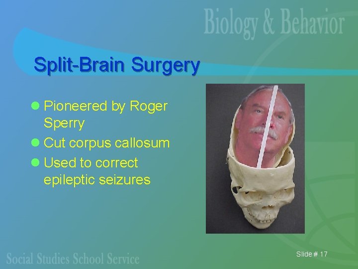 Split-Brain Surgery l Pioneered by Roger Sperry l Cut corpus callosum l Used to