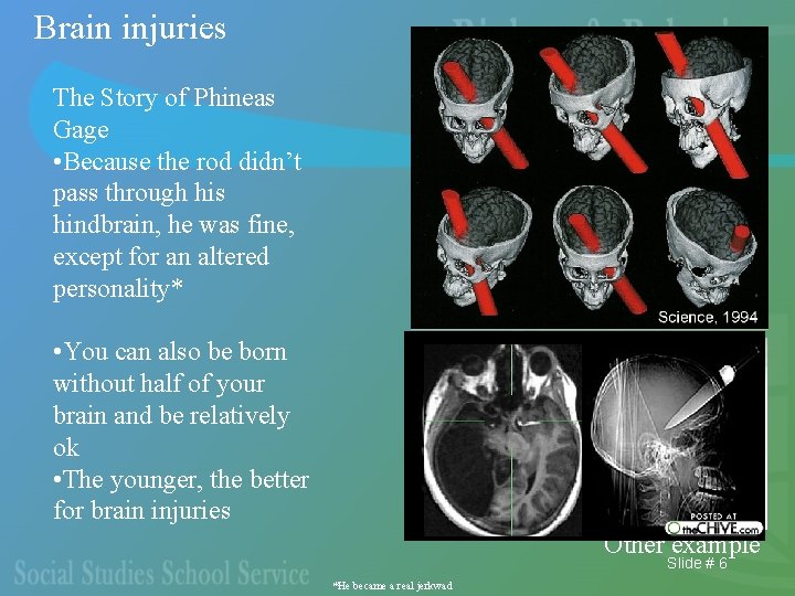 Brain injuries The Story of Phineas Gage • Because the rod didn’t pass through