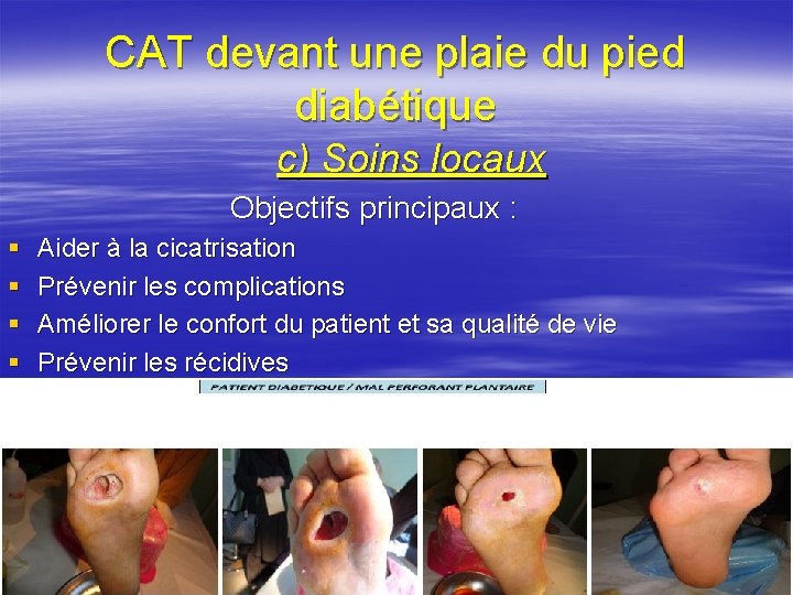 CAT devant une plaie du pied diabétique c) Soins locaux Objectifs principaux : §