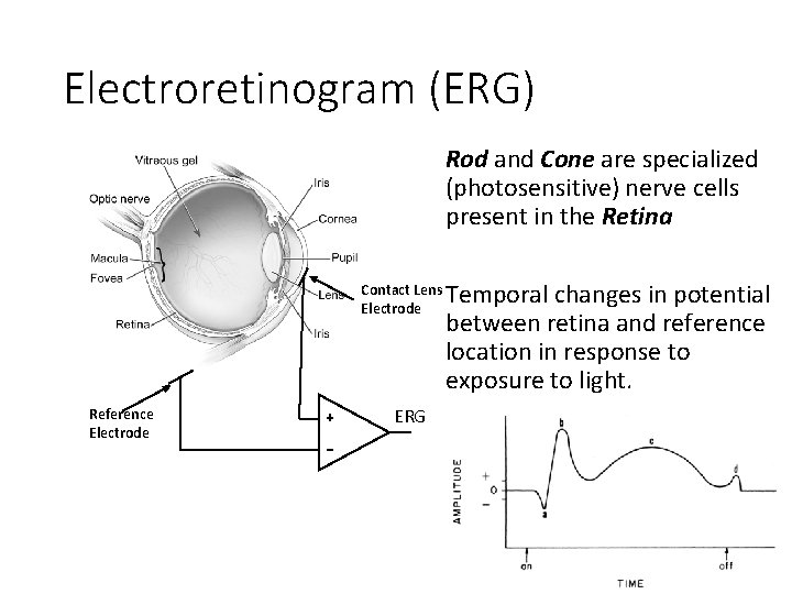 Electroretinogram (ERG) Rod and Cone are specialized (photosensitive) nerve cells present in the Retina
