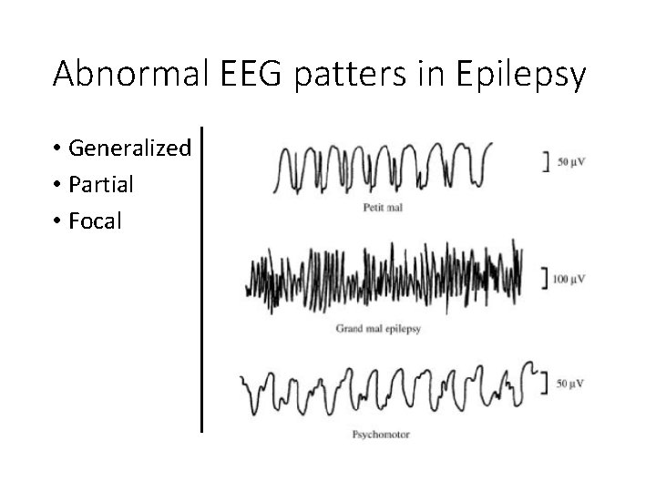 Abnormal EEG patters in Epilepsy • Generalized • Partial • Focal 