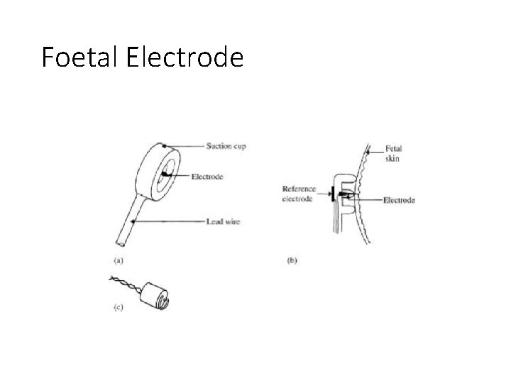 Foetal Electrode 