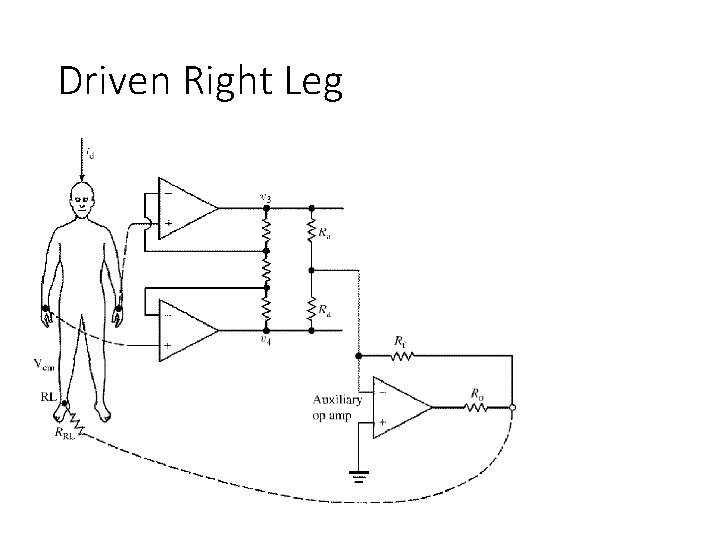 Driven Right Leg 