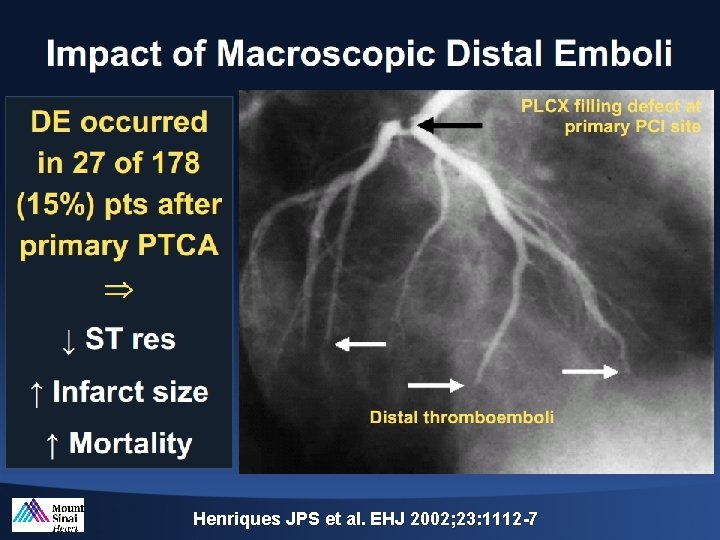 Henriques JPS et al. EHJ 2002; 23: 1112 -7 