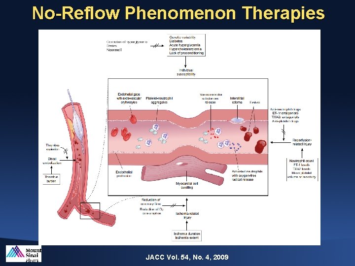 No-Reflow Phenomenon Therapies JACC Vol. 54, No. 4, 2009 