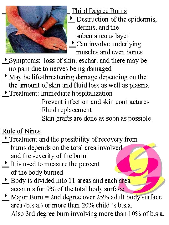 Third Degree Burns Destruction of the epidermis, and the subcutaneous layer Can involve underlying