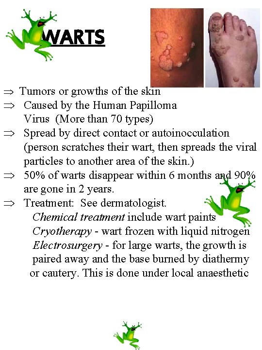 WARTS Tumors or growths of the skin Caused by the Human Papilloma Virus (More