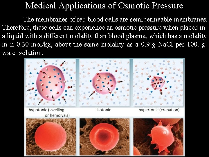 Medical Applications of Osmotic Pressure The membranes of red blood cells are semipermeable membranes.