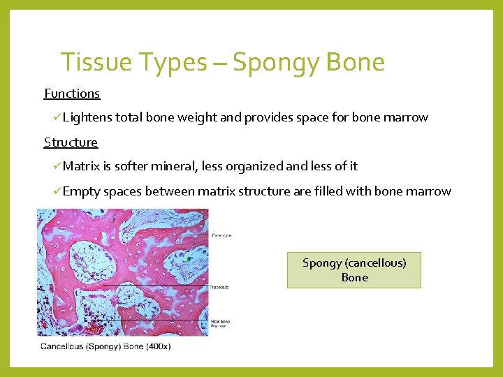 Tissue Types – Spongy Bone Functions üLightens total bone weight and provides space for