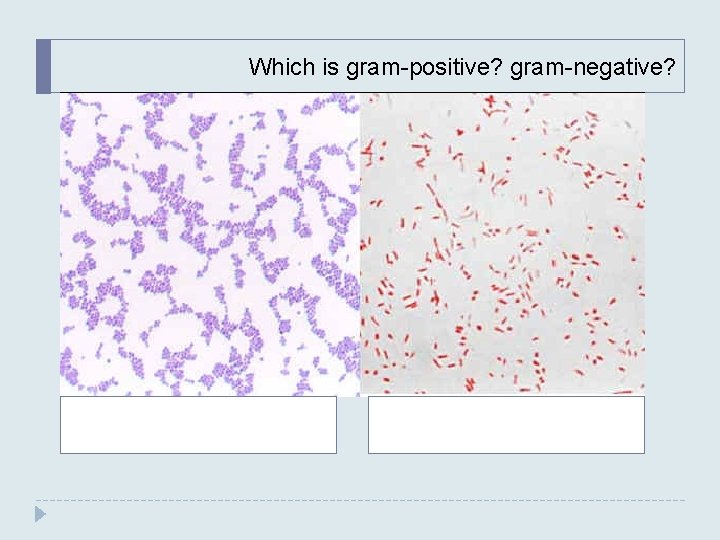 Which is gram-positive? gram-negative? Which is gram-positive? gram-negative?