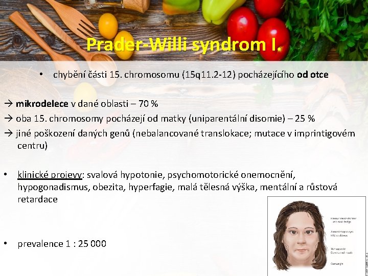 Prader-Willi syndrom I. • chybění části 15. chromosomu (15 q 11. 2 -12) pocházejícího