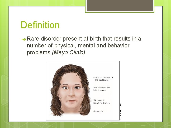 Definition Rare disorder present at birth that results in a number of physical, mental Definition Rare disorder present at birth that results in a number of physical, mental
