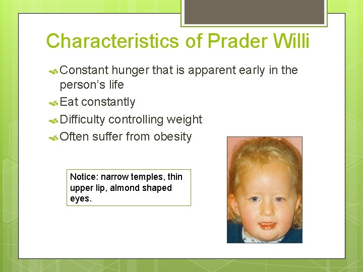 Characteristics of Prader Willi Constant hunger that is apparent early in the person’s life Characteristics of Prader Willi Constant hunger that is apparent early in the person’s life
