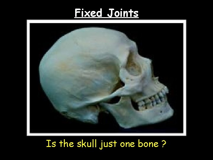 Fixed Joints Is the skull just one bone ? 