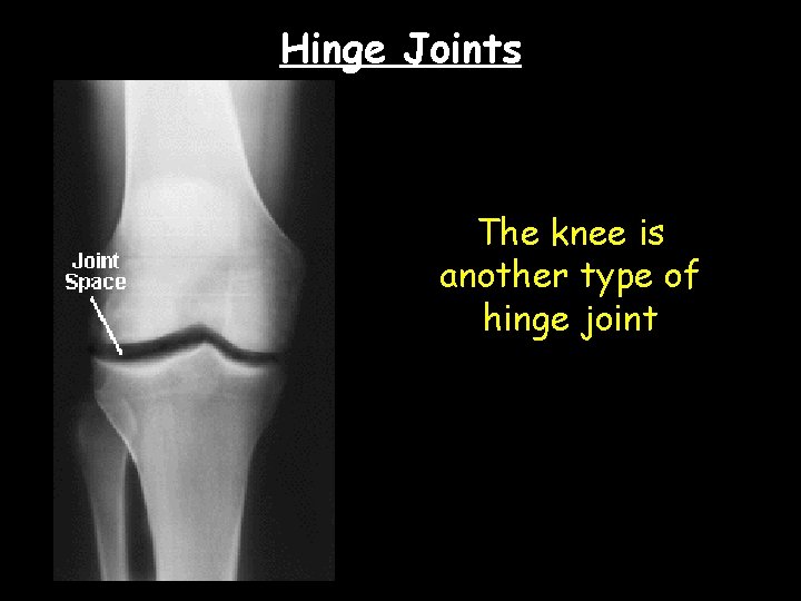 Hinge Joints The knee is another type of hinge joint 