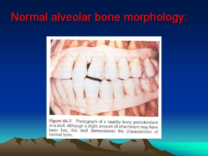 Normal alveolar bone morphology: 