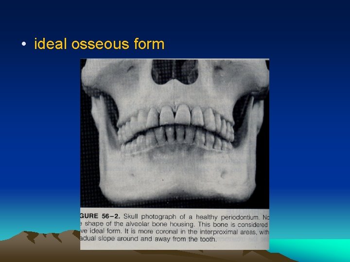  • ideal osseous form 
