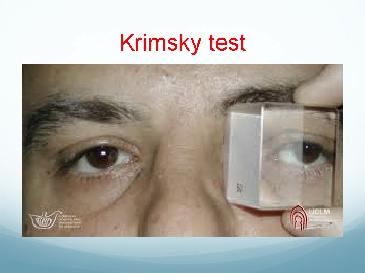 Krimsky test 
