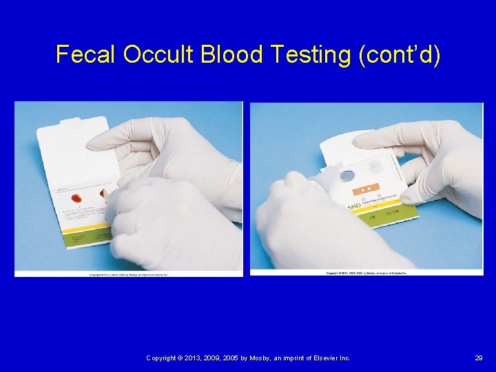 Fecal Occult Blood Testing (cont’d) Copyright © 2013, 2009, 2005 by Mosby, an imprint