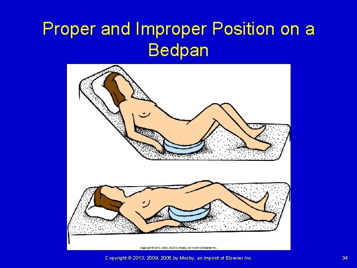 Proper and Improper Position on a Bedpan Copyright © 2013, 2009, 2005 by Mosby,