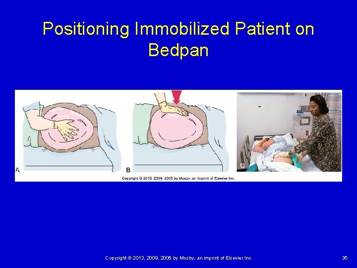 Positioning Immobilized Patient on Bedpan Copyright © 2013, 2009, 2005 by Mosby, an imprint