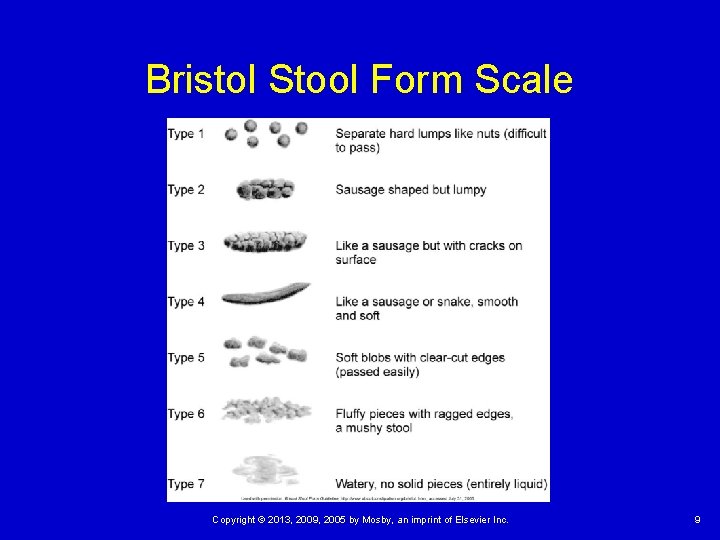 Bristol Stool Form Scale Copyright © 2013, 2009, 2005 by Mosby, an imprint of