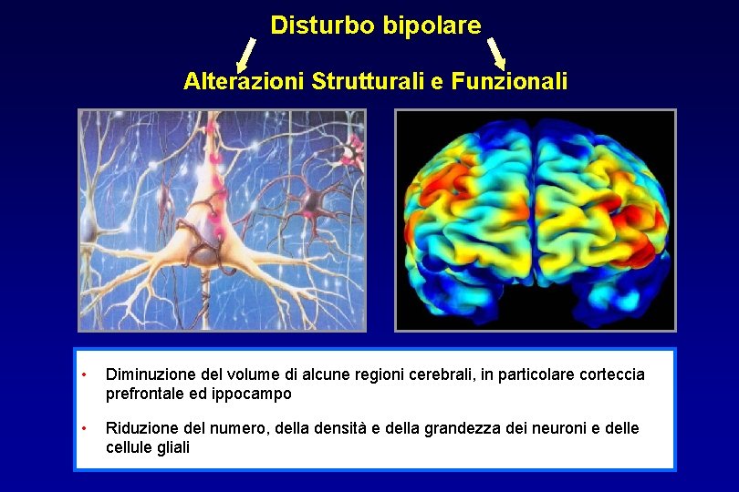Disturbo bipolare Alterazioni Strutturali e Funzionali • Diminuzione del volume di alcune regioni cerebrali,