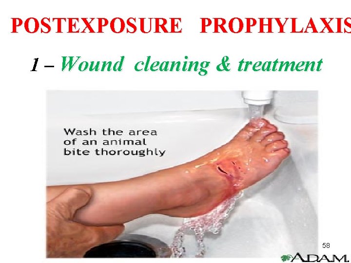 POSTEXPOSURE PROPHYLAXIS 1 – Wound cleaning & treatment 58 